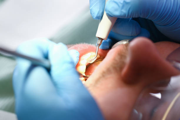 Best Tooth Infection Emergency Dentist  in Cardington, OH