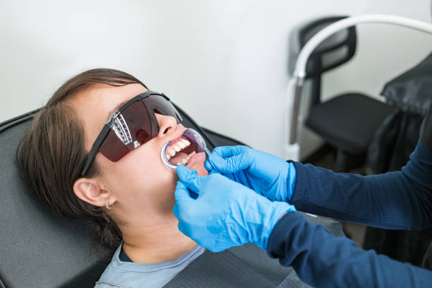 Teeth Whitening in OH