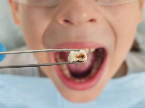 Best Broken Tooth Emergency  in Cardington, OH
