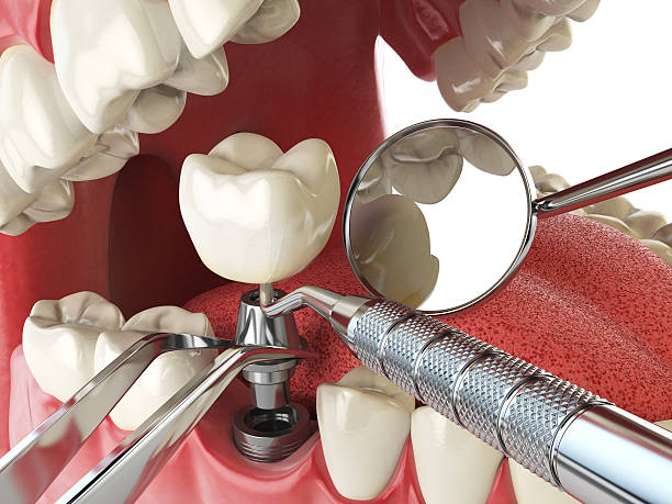 Best Tooth Pain Emergency Relief  in Cardington, OH