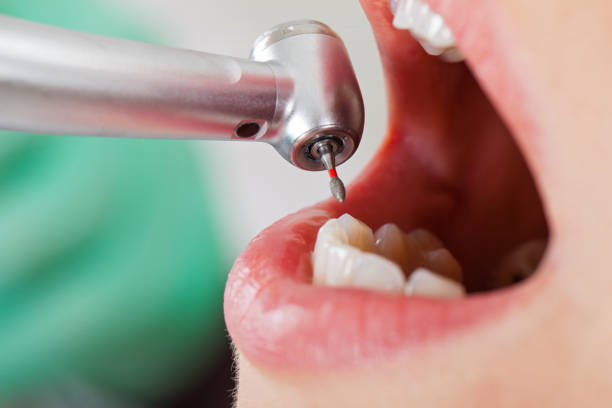 Best Knocked-Out Tooth Emergency  in Cardington, OH